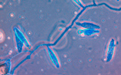Microsporum sp. is a dermatophyte, which causes infections of keratinized tissue (hair, skin, nails)