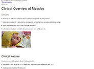 Clinical Overview of Measles | CDC